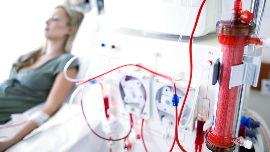 Hemodiálise